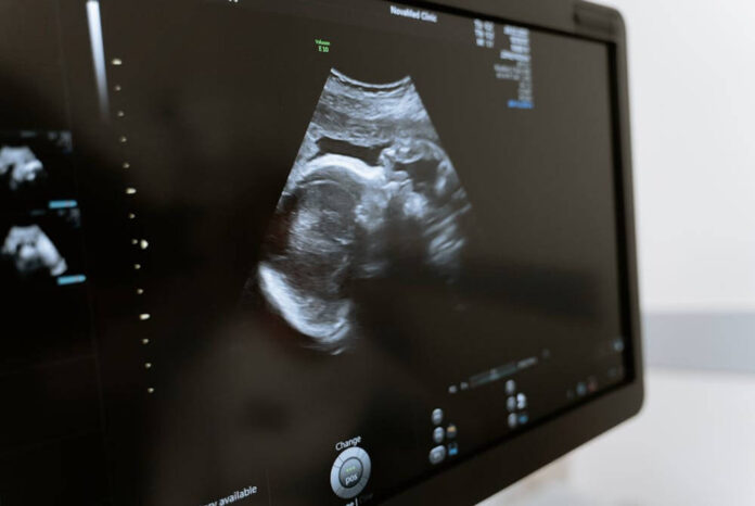 How Much Do Sonographers Make in Texas